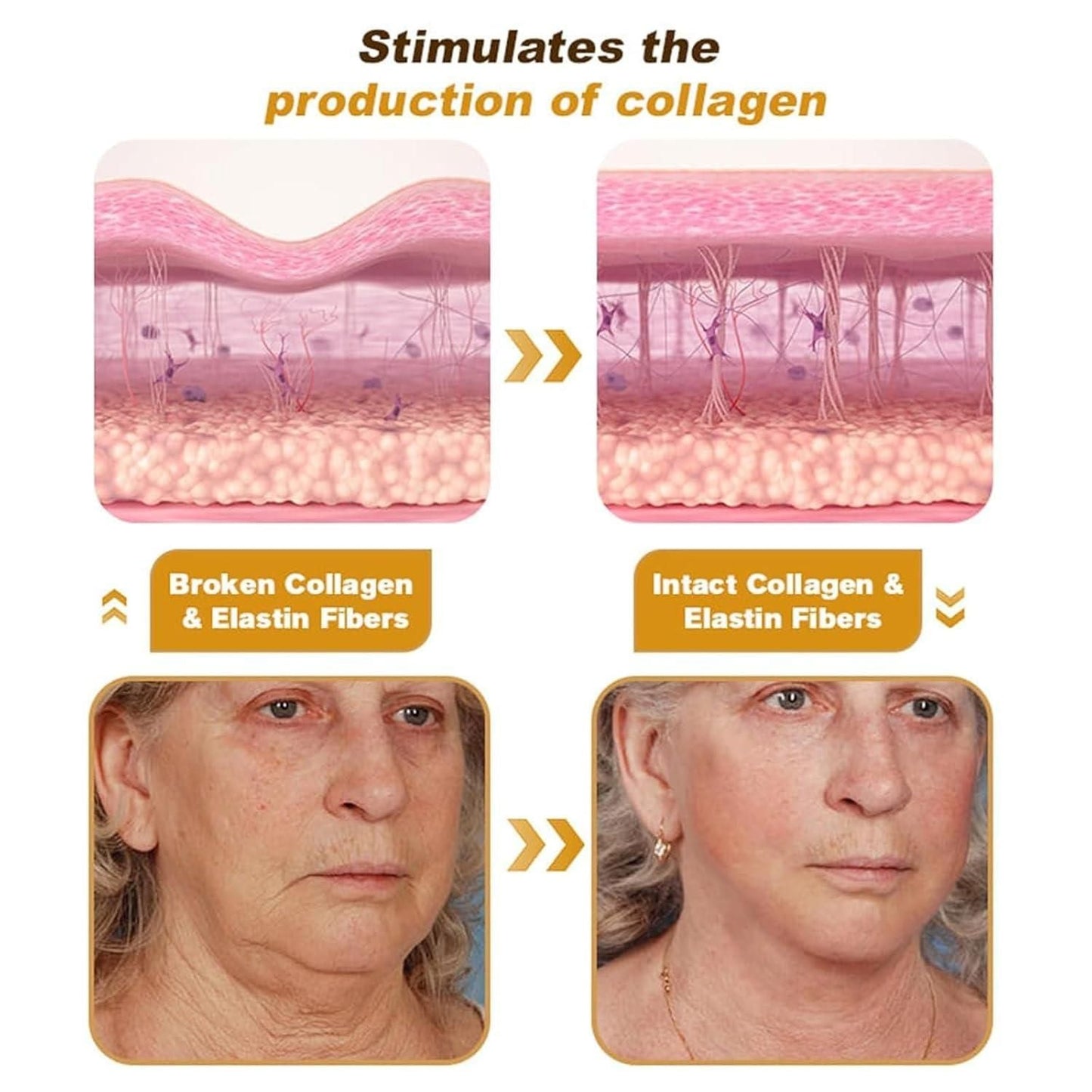 BeeTox™ - Bee Venom Wrinkle Repair Cream (buy 1 get 1 free)